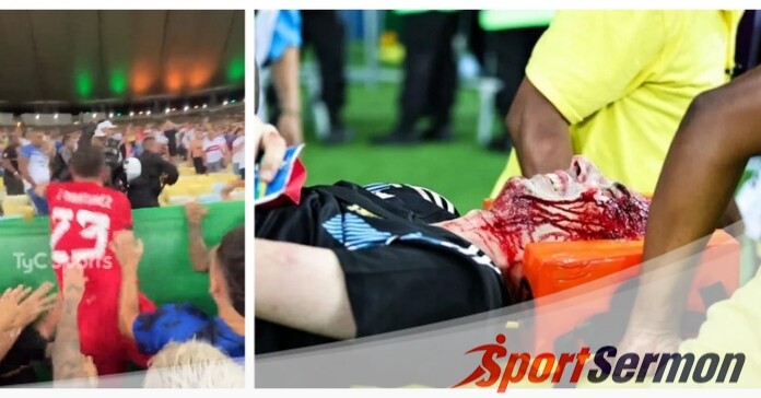 Argentina v Brazil Match Marred by Police Brutality  