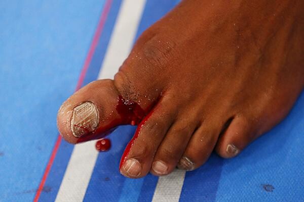 10 Most Horrifying Injuries In The History Of MMA  