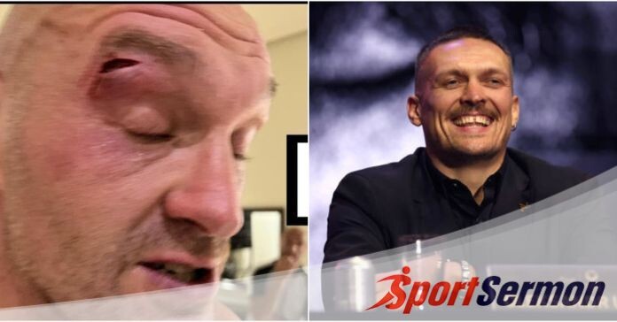 Tyson Fury Suffers Elbow Cut, Bout with Oleksandr Shifted  