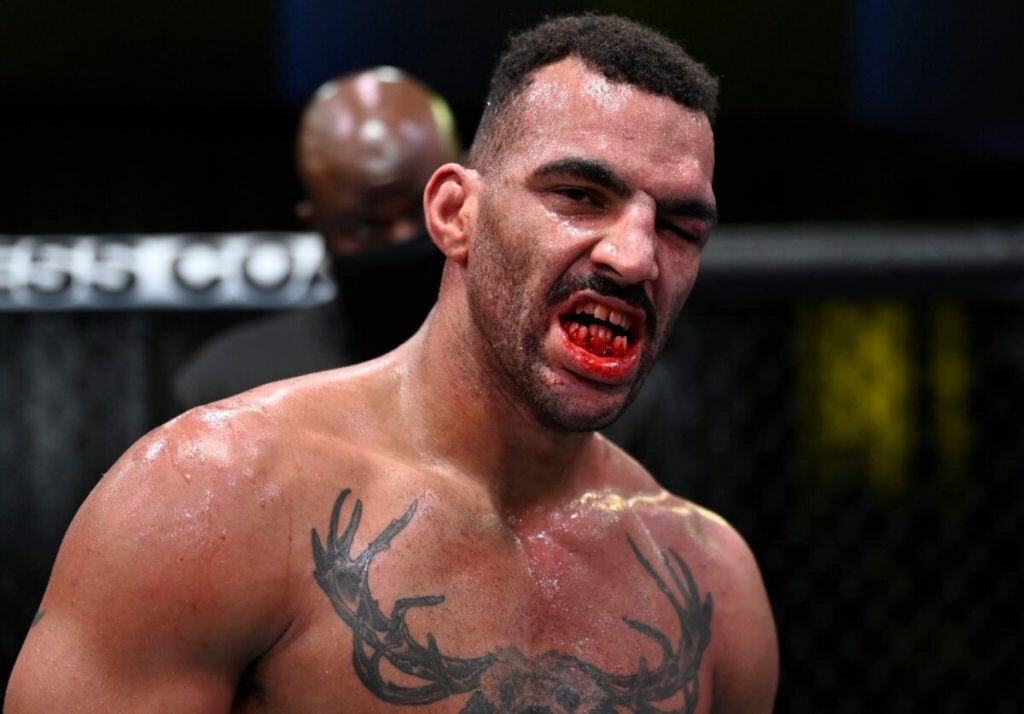 10 Most Horrifying Injuries In The History Of MMA  