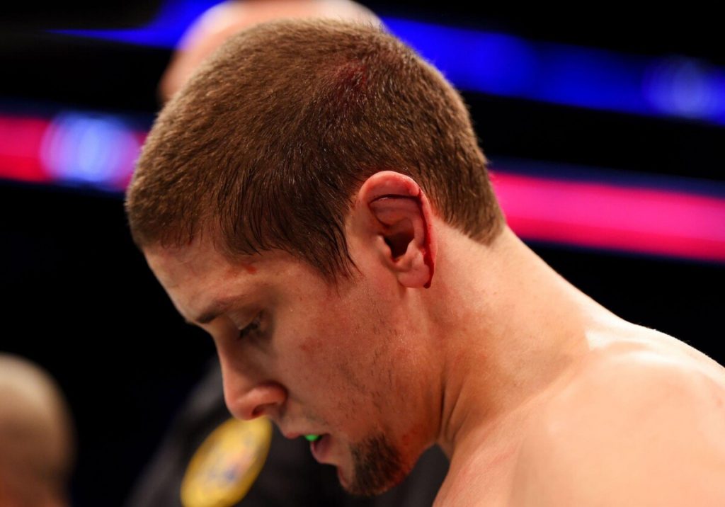 Cauliflower Ears: What is it & Why It Occurs To Fighters  