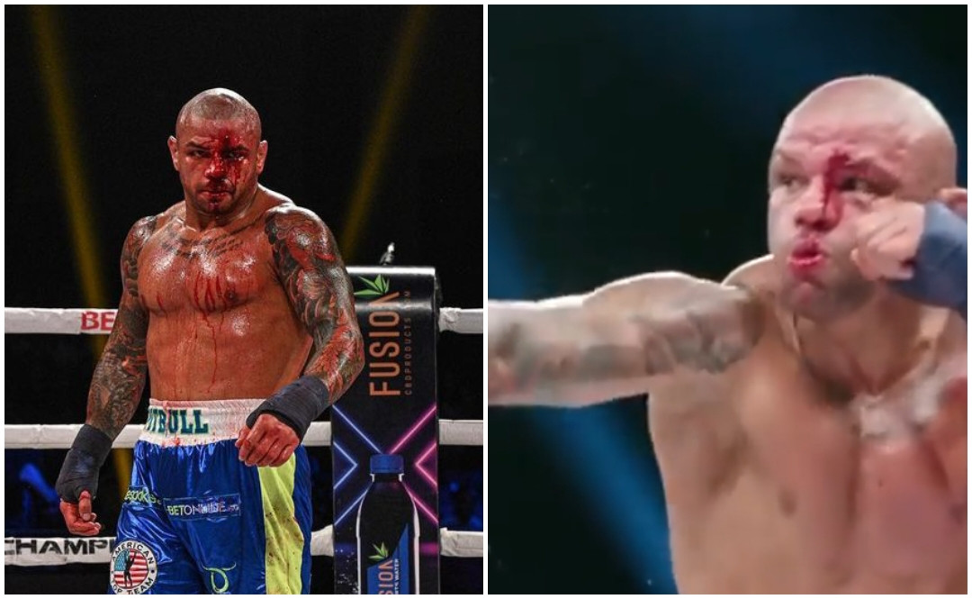 Veteran MMA Fighter Thiago Alves Announces Retirement After BKFC Loss  