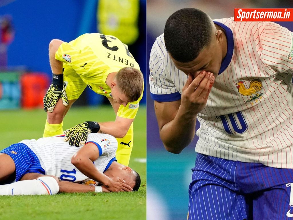 Kylian Mbappe के नाक में लगी चोट, ट्विटर पर फैंस से मांगा मास्क के लिए आइडिया  