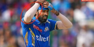 Cricketers खेलते समय Arm Sleeves क्यों पहनते हैं? असल वजह क्या है? जानिए  