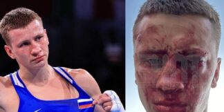 Russian Boxer Dmitry Dvali Sacrifices Sight to Save Child  