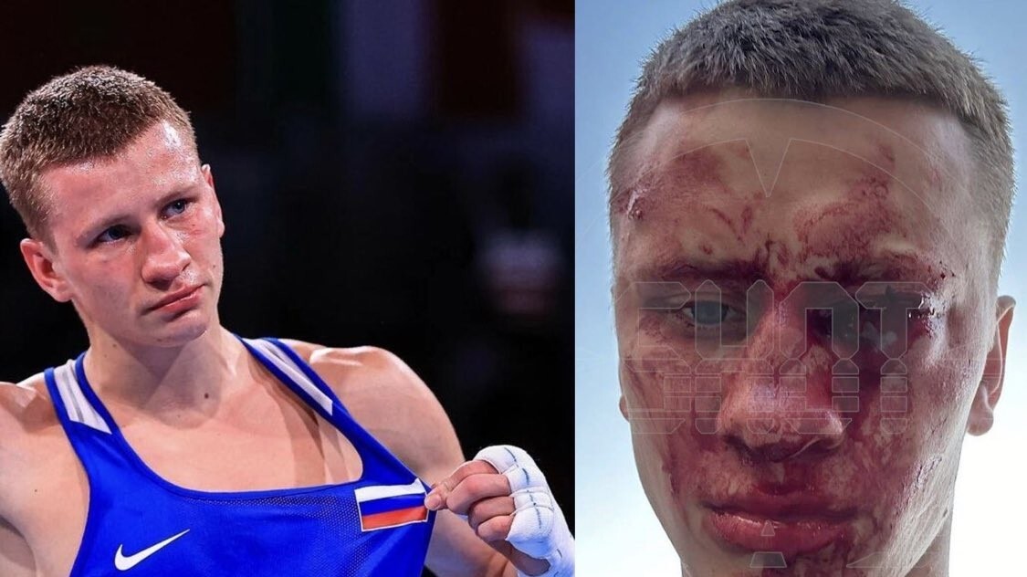 Russian Boxer Dmitry Dvali Sacrifices Sight to Save Child   Russian Boxer Dmitry Dvali Sacrifices Sight to Save Child