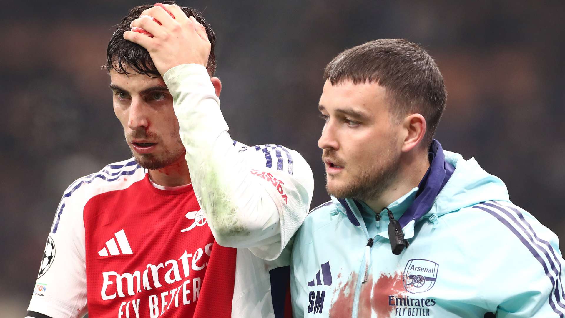 Arsenal issue Havertz update after nasty head injury   Arsenal issue Havertz update after nasty head injury