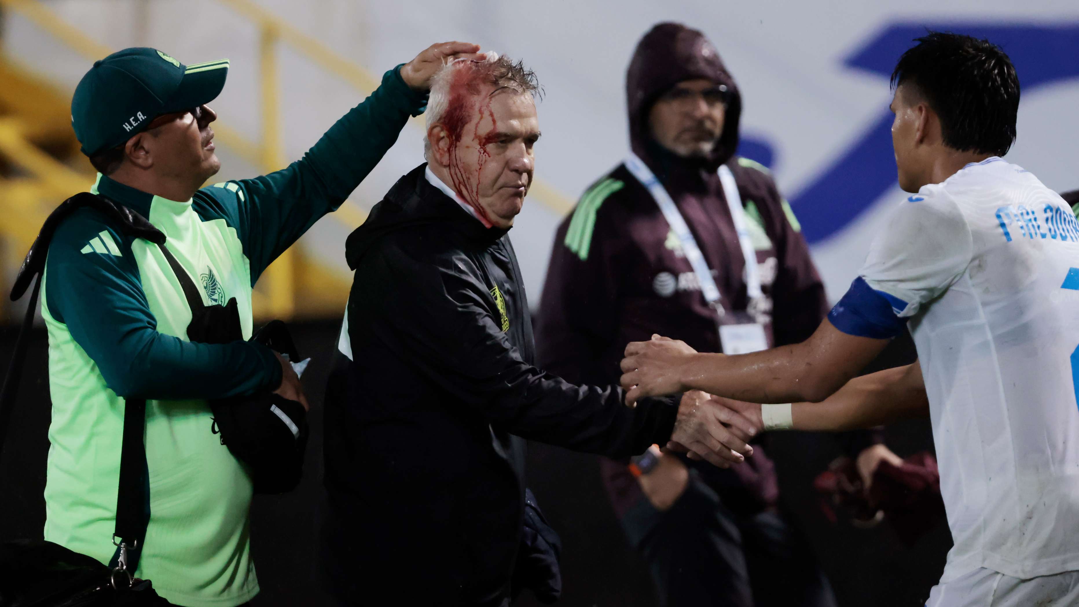 📽️ | Mexico boss left bloodied after being hit by missile  