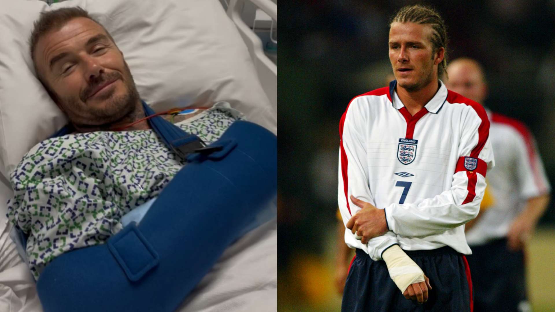 Beckham's 'secret' surgery! Broken bone fixed after 22 years  