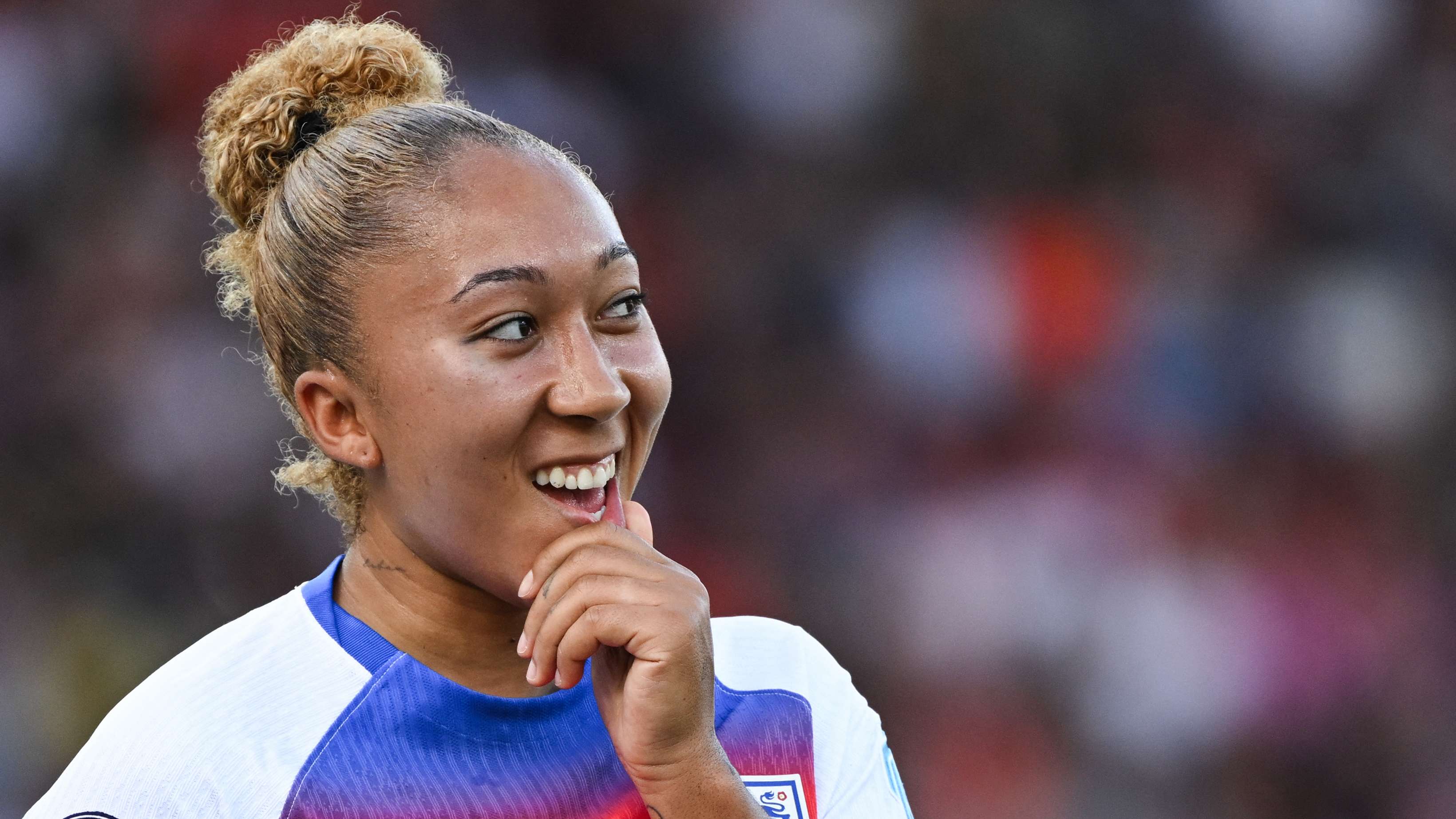 'That's why I don't go for headers!' - James shows off black eye  