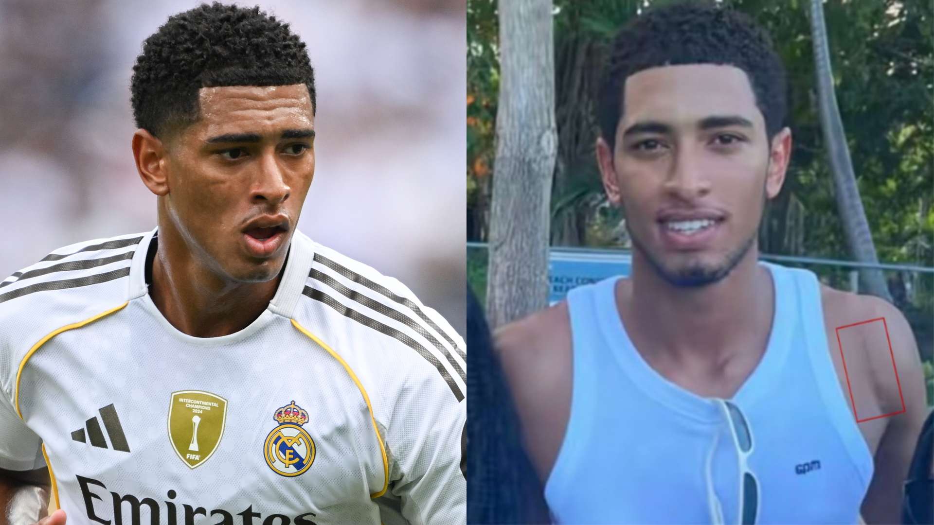 Real Madrid star Bellingham shows off shoulder surgery scar  