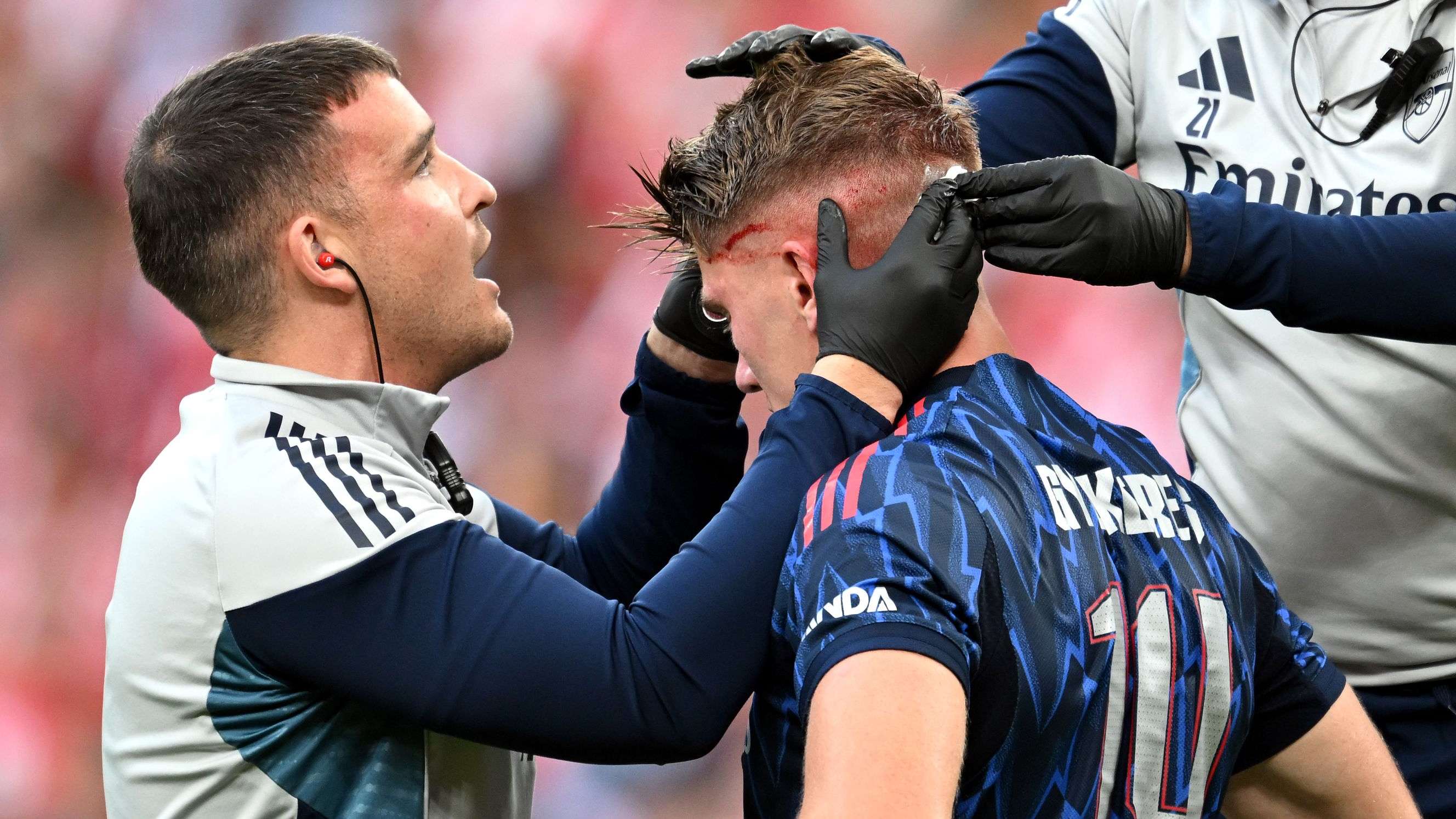 Gyokeres left bloodied in Arsenal injury scare after nasty clash  