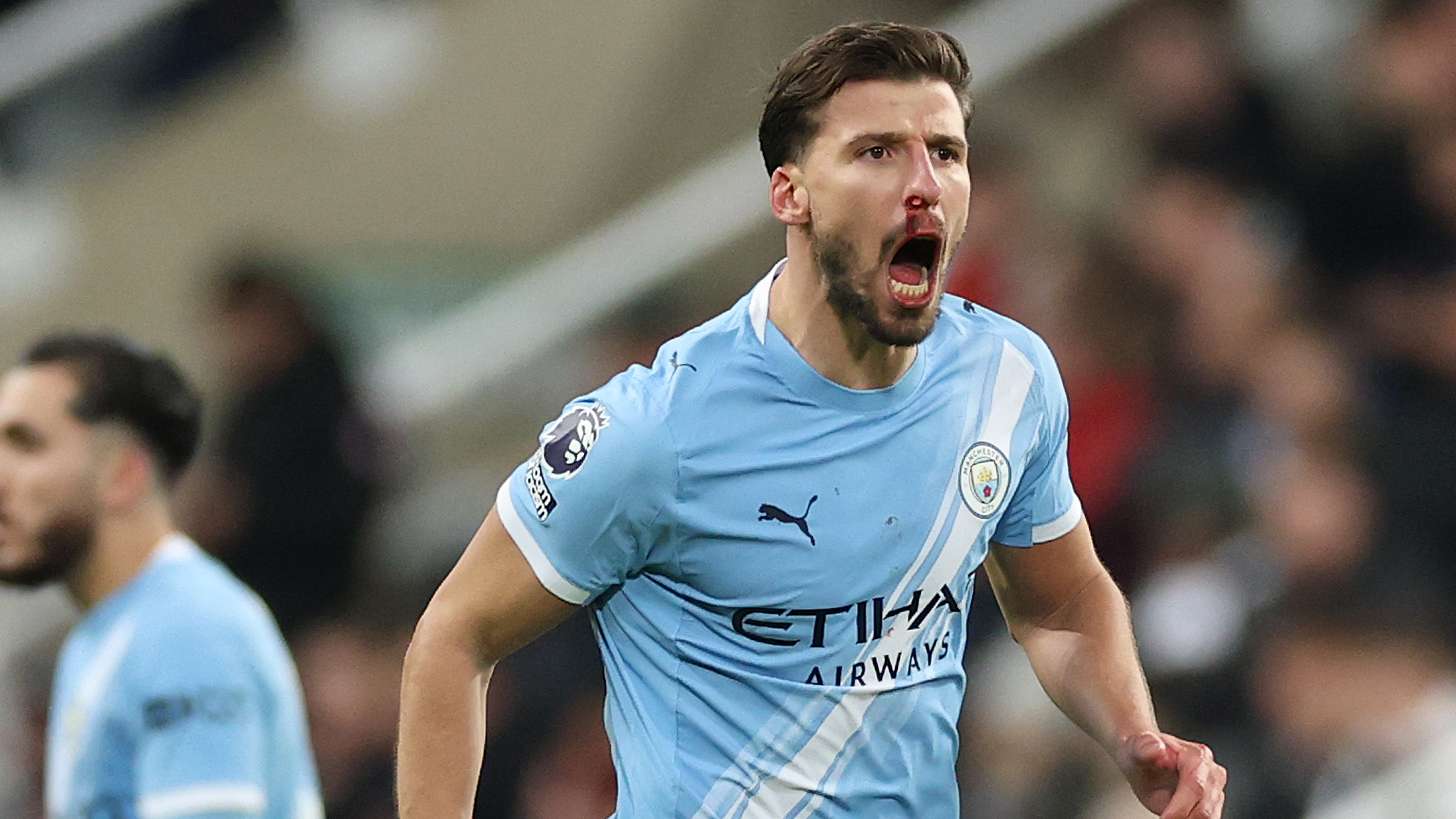 Furious Dias calls for clarity after City beaten at Newcastle  