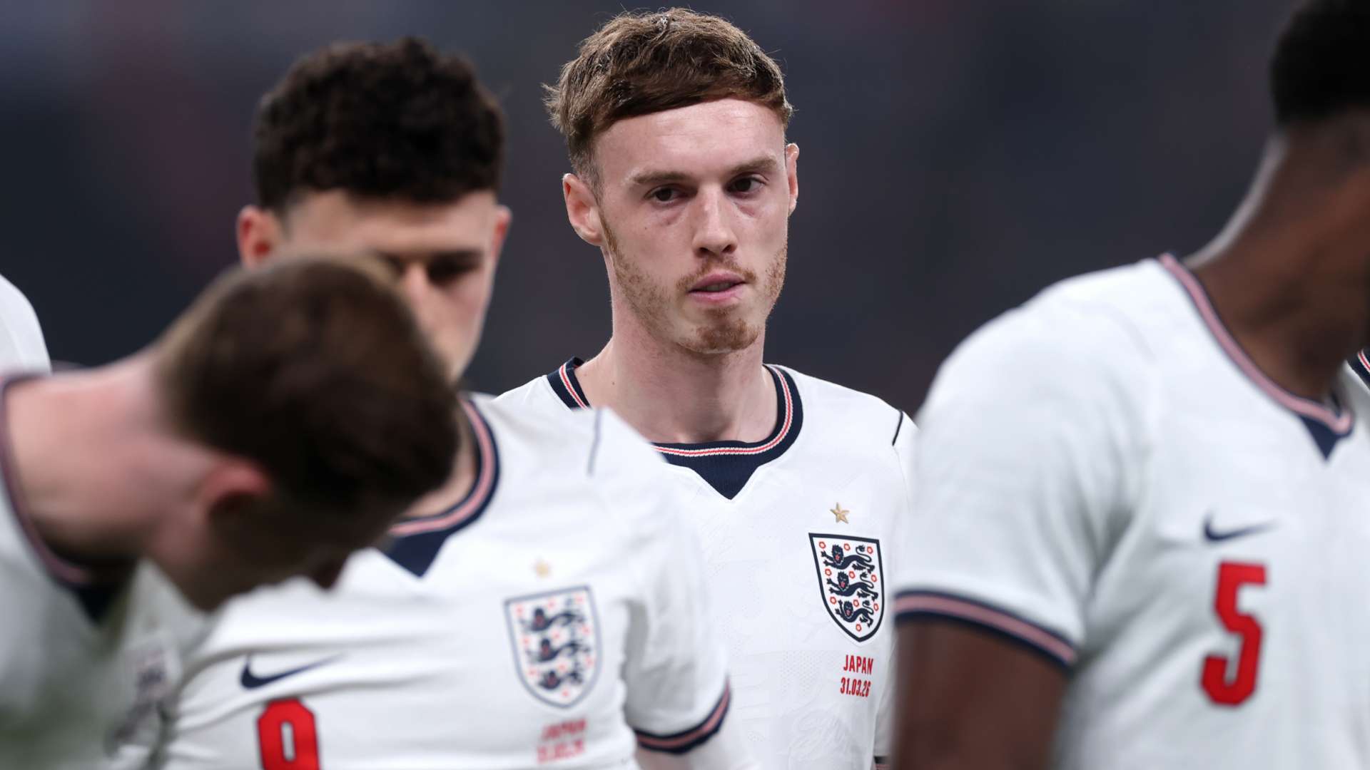 Palmer doesn’t ‘play games’ amid England ‘injury’ questions  