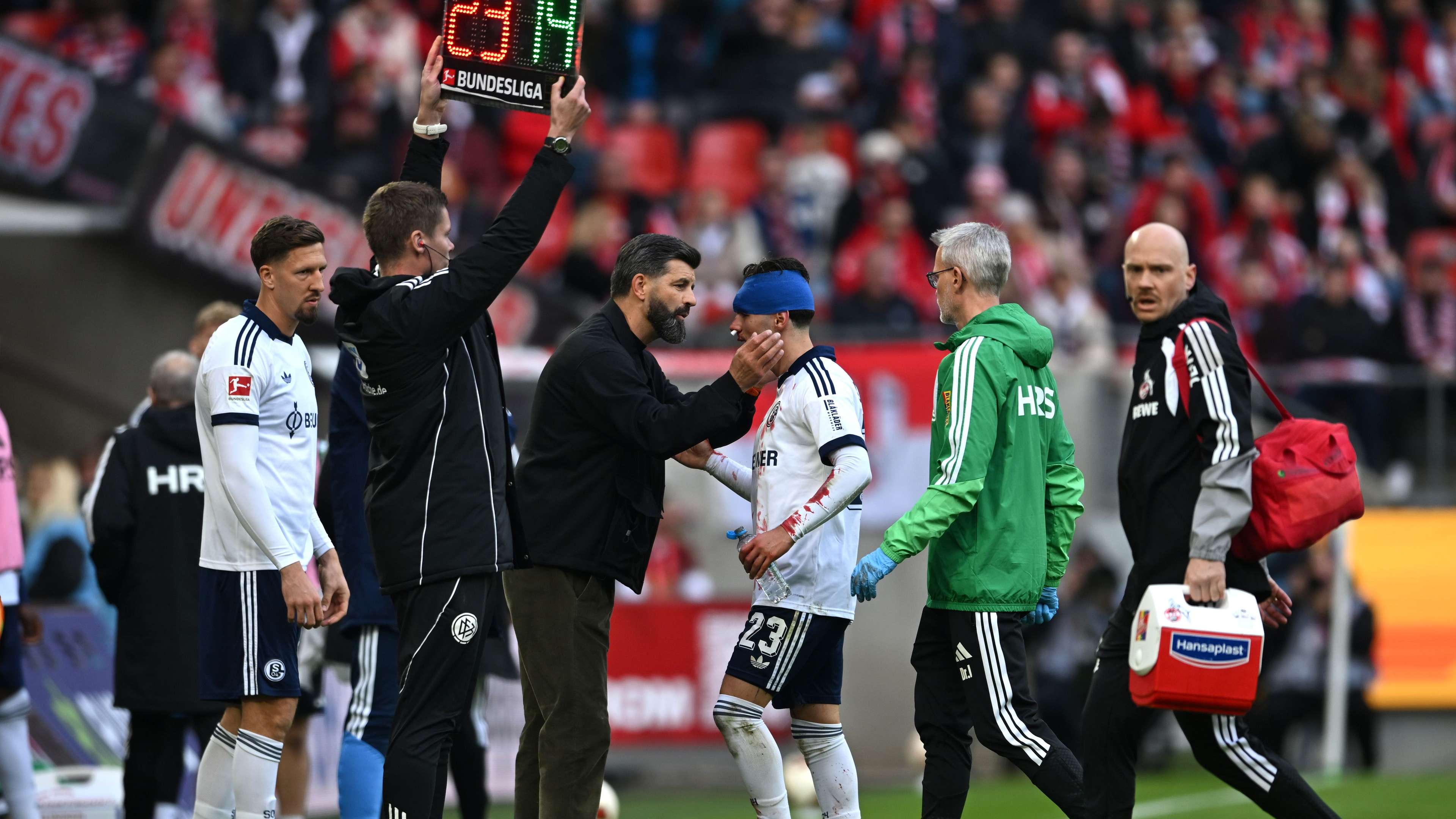 A powerful blow and heavy bleeding: horrific injury for Morocco star  